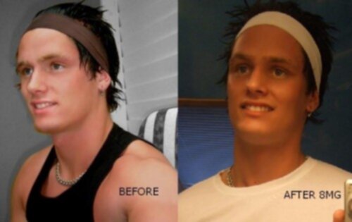 solarium före och efter solarium före och efter